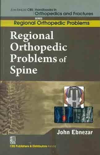 9788123921280: John Ebnezar CBS Handbooks in Orthopedics and Factures: Regional Orthopedic Problems : Regional Orthopedic Problems of Spine