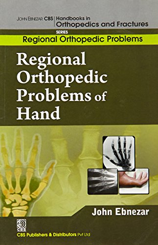 Stock image for John Ebnezar CBS Handbooks in Orthopedics and Factures: Regional Orthopedic Problems : Regional Orthopedic Problems of Hand for sale by Romtrade Corp.
