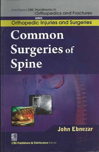 9788123921396: John Ebnezar CBS Handbooks in Orthopedics and Factures: Orthopedic Injuries and Surgeries: Common Surgeries of Spine