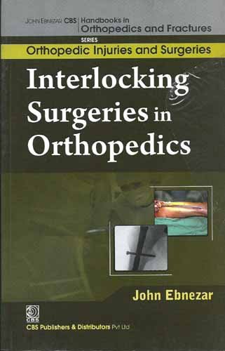 Stock image for Interlocking Surgeries In Orthopedics (Handbooks In Orthopedics And Fractures Series, Vol. 60-Orthopedic Injuries And Surgeries) for sale by GF Books, Inc.