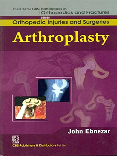 Stock image for John Ebnezar CBS Handbooks in Orthopedics and Factures: Orthopedic Injuries and Surgeries : Arthroplasty for sale by Romtrade Corp.