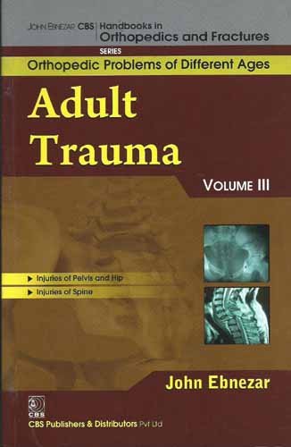 Imagen de archivo de Adult Trauma Vol. 111 (Handbooks In Orthopedics And Fractures Series Vol. 77 Orthopedic Problems Of Different Ages a la venta por Books in my Basket