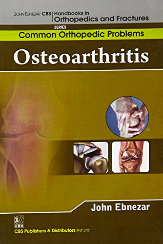 Stock image for John Ebnezar CBS Handbooks in Orthopedics and Factures: Common Orthopedic Problems : Osteoarthritis for sale by Romtrade Corp.