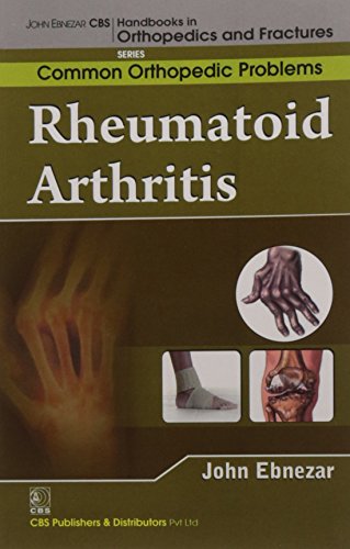 9788123921723: Rheumatoid Arthritis (Handbooks In Orthopedics And Fractures Series, Vol. 92-Common Orthopedic Problems )