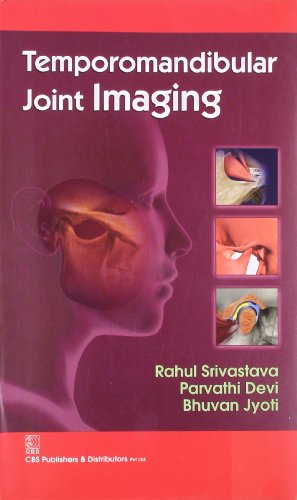 9788123923970: Temporomandibular Joint Imaging (Pb-2014)