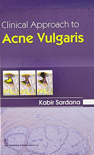 Stock image for Clinical Approach To Acne Vulgaris (2015) for sale by Kanic Books