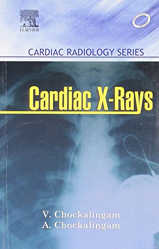 Stock image for Cardiac X-Rays Cardiac Radiology Series for sale by Mispah books