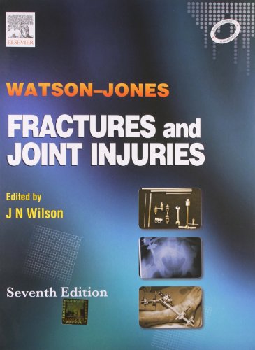 9788131211595: Watson-Jones Fractures & Joint Injuries