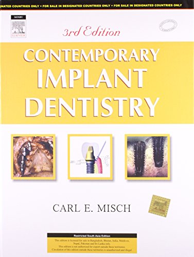 9788131215104: Contemporary Implant Dentistry