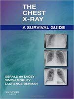 Stock image for THE CHEST X-RAY A SURVIVAL GUIDE (PB 2023) for sale by Romtrade Corp.