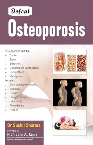 Beispielbild fr Defeat Osteoporosis zum Verkauf von Reuseabook