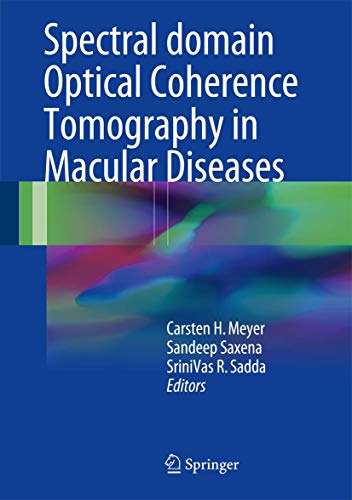 Stock image for Spectral Domain Optical Coherence Tomography in Macular Diseases for sale by HPB-Red
