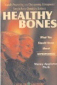 9788170215899: Healthy Bones: What You Should Know About Osteoporosis
