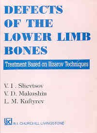 9788170421535: Defects Of The Lower Limb Bones