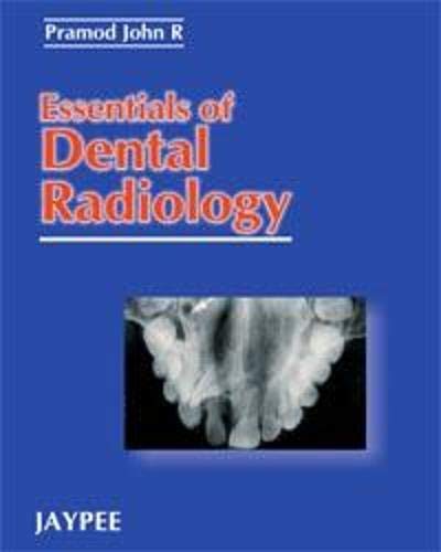 9788171796700: Essentials of Dental Radiology