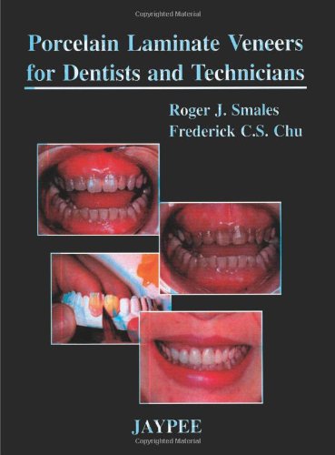 Beispielbild fr PORCELAIN LAMINATE VENEERS FOR DENTISTS AND TECHNICIANS zum Verkauf von Reuseabook