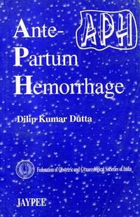 ANTE PARTUM HEMORRHAGE (FOGSI) (9788171798124) by Dutta