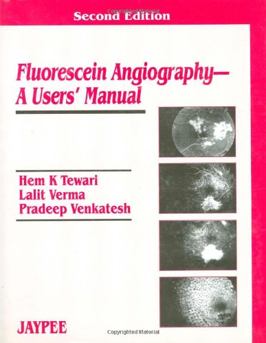 Imagen de archivo de Fluorescein Angiography a la venta por dsmbooks