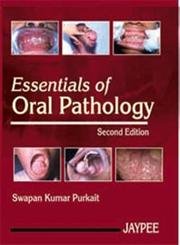 Stock image for Essentials of Oral Pathology for sale by Hippo Books