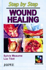 9788180613821: Step by Step Wound Healing