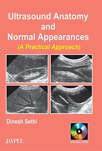 Ultrasound Anatomy and Normal Appearances (with CD) (9788180614385) by Sethi