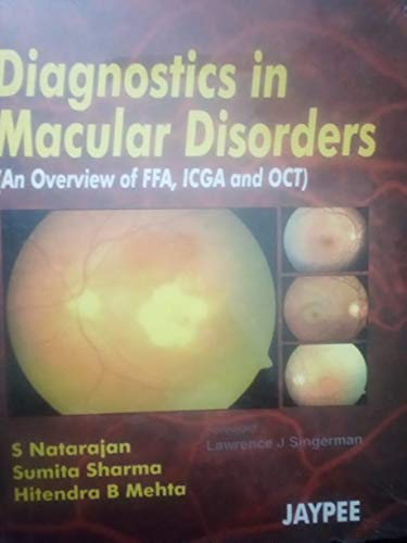 Stock image for Diagnostics in Macular Disorders for sale by Books Puddle