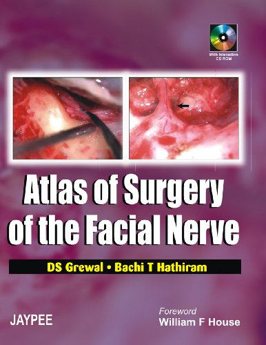 Atlas of Surgery of the Facial Nerve with DVD-ROM (9788180615665) by Grewal