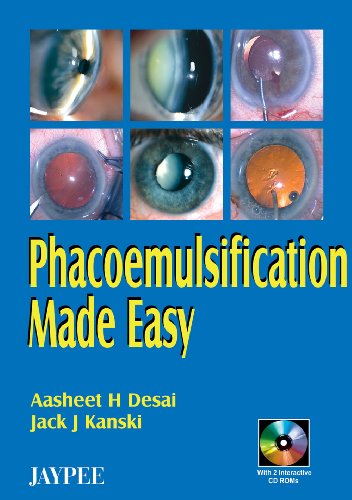 9788180615979: Phacoemulsification Made Easy with 2 CD-Roms