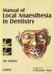 Imagen de archivo de Manual of Local Anaesthesia In Dentistry a la venta por Books in my Basket