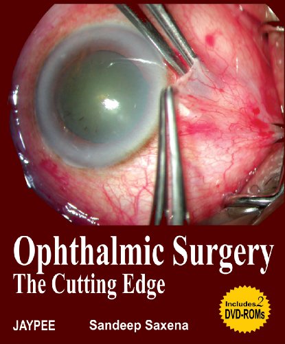 Stock image for Ophthalmic Surgery for sale by Books Puddle