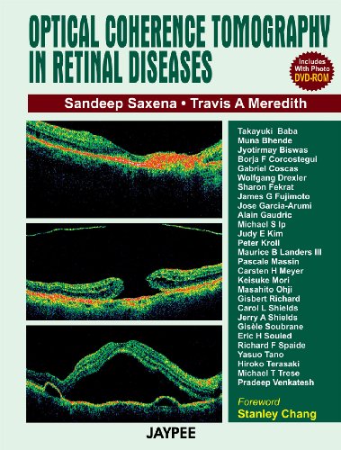 Stock image for Optical Coherence Tomography in Retinal Diseases for sale by Books Puddle