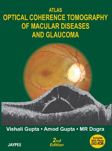 Atlas Optical Coherence Tomography of Macular Diseases and Glaucoma (9788180616532) by Gupta