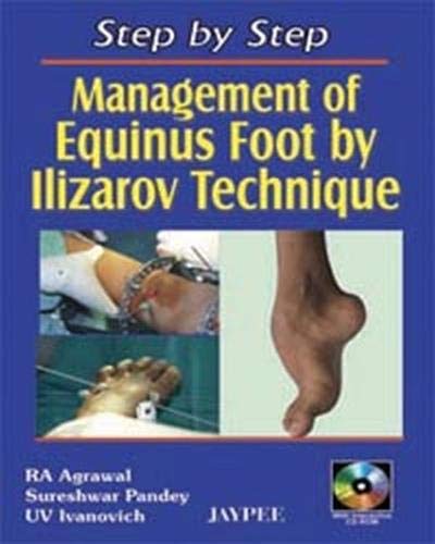 Step by Step: Management of Equinus Foot by Ilizarov Technique (9788180617102) by Agrawal, Ra