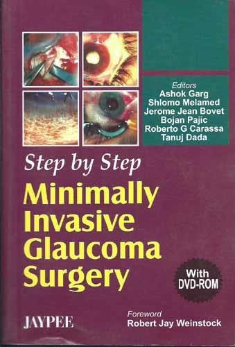 Stock image for STEP BY STEP MINIMALLY INVASIVE GLAUCOMA SURGERY WITH DVD-ROM for sale by Basi6 International