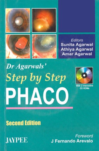 9788180617522: Dr. Agarwal's Step by Step Phaco with 2 Interactive CD-ROMs