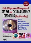9788180617751: Clincl Diagnosis Management of Dry Eye