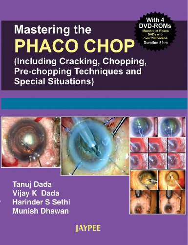 Stock image for Mastering the Nucleotomy Techniques in Phaco for sale by Books Puddle