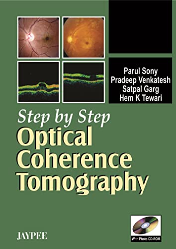 Step by Step Optical Coherence Tomography with Photo CD-ROM (9788180619595) by Sony