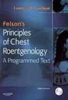 9788181474841: Felsons Principles Of Chest Roentgenology, 2E [Paperback] [Jan 01, 2015] Goodman J.W.