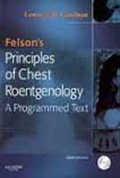 Stock image for Felsons Principles Of Chest Roentgenology, 2E for sale by Urban Book Limited