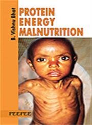 Beispielbild fr Protein Energy Malnutrition: Volume 1 zum Verkauf von Blackwell's