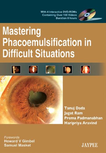 Stock image for MASTERING PHACOEMULSIFICATION IN DIFFICULT SITUATIONS WITH 4 DVD-ROMS for sale by Romtrade Corp.