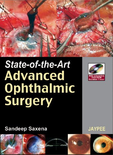 Stock image for State of the Art Advanced Ophthalmic Surgery for sale by Books Puddle
