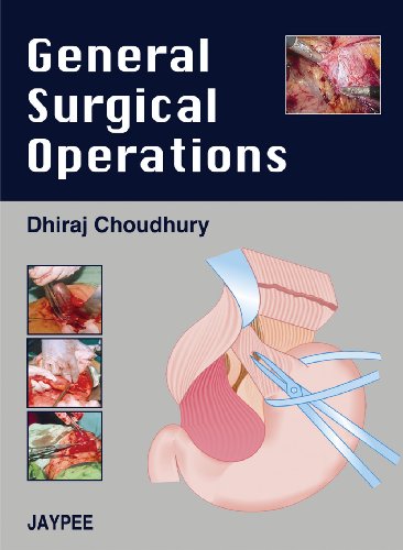 9788184481952: General Surgical Operations