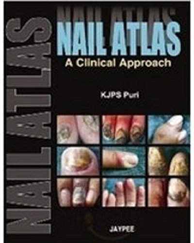 9788184482041: NAIL ATLAS A CLINICAL APPROACH