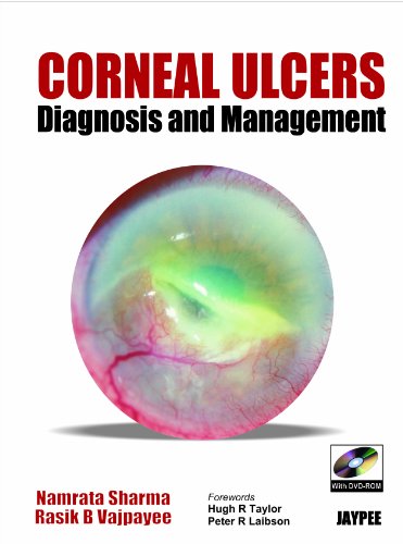 9788184482171: Corneal Ulcers Diagnosis and Management