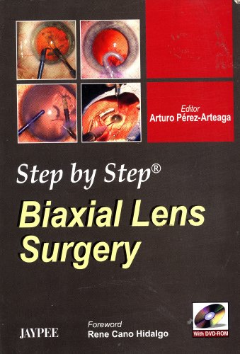 Stock image for Step By Step Biaxial Lens Surgery for sale by Masalai Press