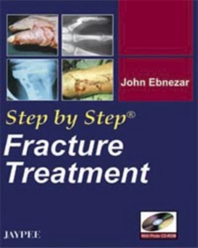 9788184482546: Fracture Treatment (Step by Step)