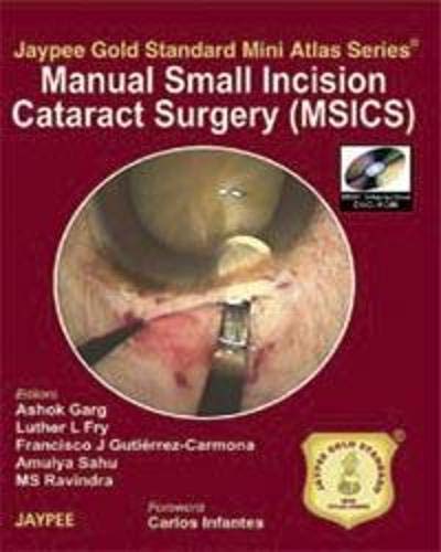 9788184482768: Jaypee Gold Standard Mini Atlas Series: Manual Small Incision Cataract Surgery (MSICS)