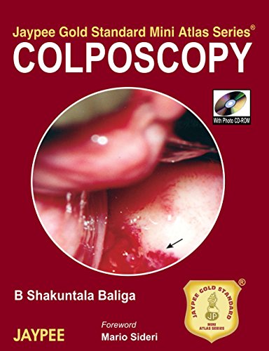 9788184483130: Colposcopy (Jaypee Gold Standard Mini Atlas Series)
